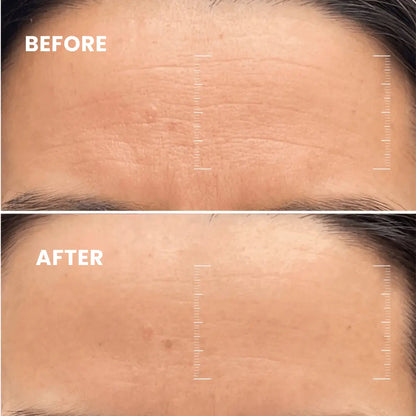 Maschera da notte stimolante al collagene Lumiéra Mask | Pelle visibilmente più giovane in soli 7 giorni!